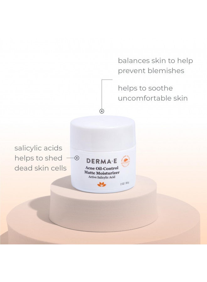 DERMA-E, Acne Rebalancing Cream Prevents Blemishes oz, 2 Ounce