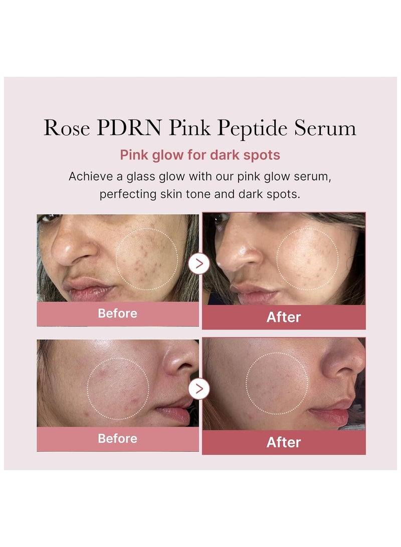 Medicube Rose PDRN Pink Peptide Serum, Pink glow serum, Vegan PDRN, Peptide, Niacinadmie, Hydrating & Moisturizing & Firming, Uneven Skin Tone, Pore Care, Korean Skincare, Vegan