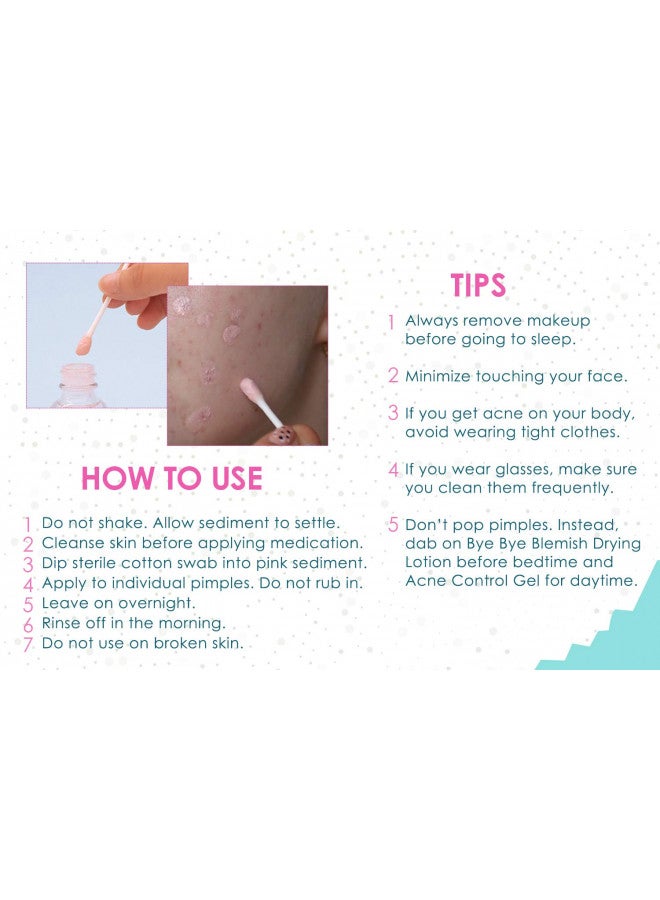 Bye Bye Blemish Acne Drying Lotion, Reduce Pimples Overnight 1oz, 3-Pack
