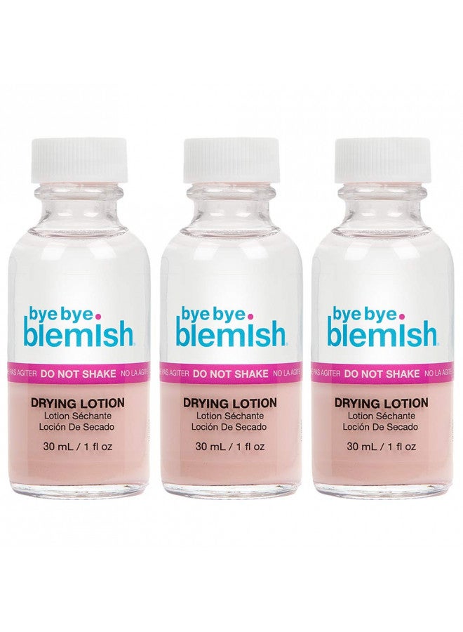 Bye Bye Blemish Acne Drying Lotion, Reduce Pimples Overnight 1oz, 3-Pack