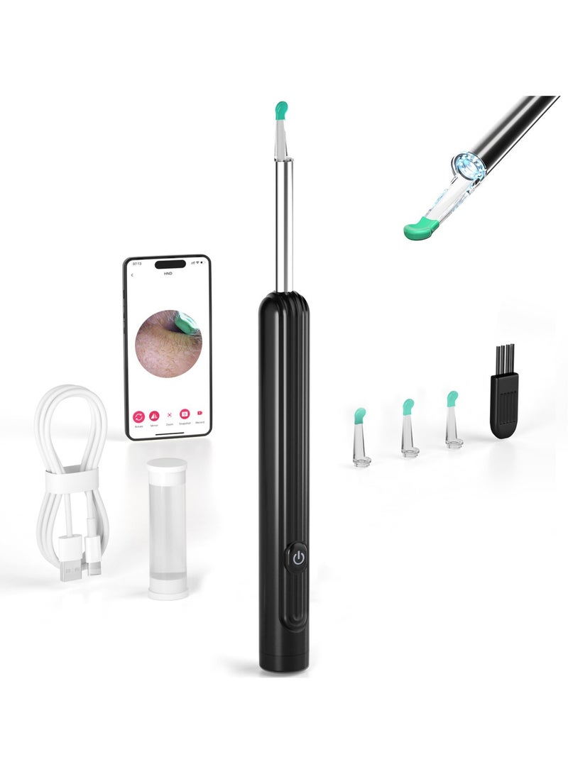 Earwax Removal - Earwax Removal Tool Camera, Ear Cleaner with Camera, Earwax Removal Kit with 1296P Camera, Ear Camera Otoscope with Light (Black)