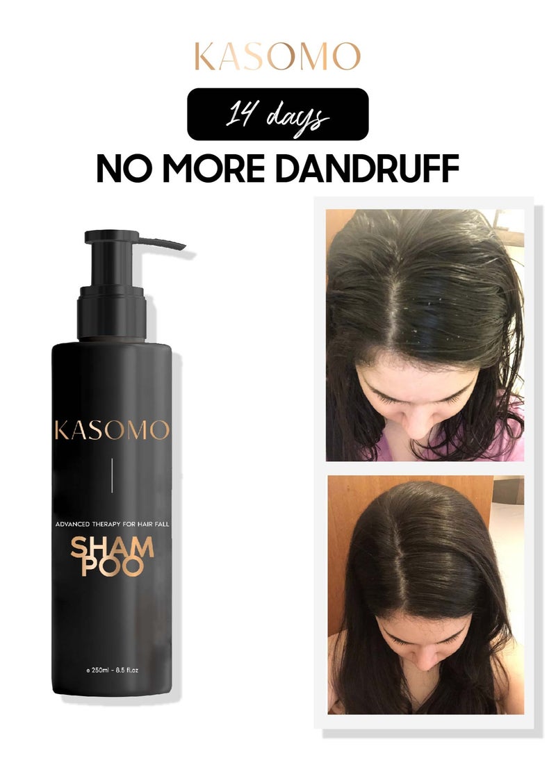 KASOMO Anti-Dandruff Shampoo 250 ml & Hair Dry Repair Mask 250ml, Deeply Moisturizing Nourishing Hair Stronger, Thicker and Healthier with Natural Ingredients