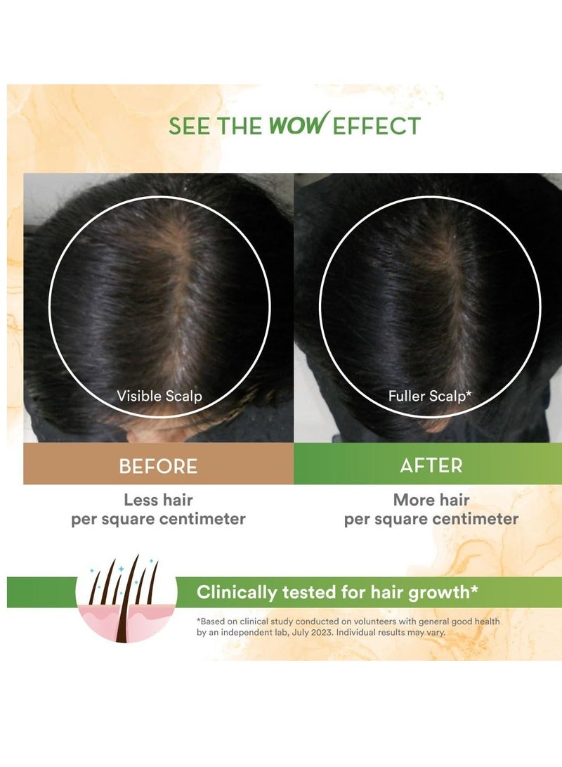 WOW Skin Science Rosemary with Biotin Hair Growth Oil | Stimulates New Hair Growth | Controls Hair Fall & Reduces Hair Breakage | Gives Healthy Hair