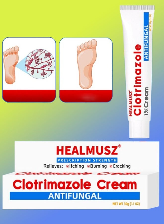 Clotrimazole Cream Athlete Foot Cream Jock Itch and Ringworm Cream Relieve Itching Burning Cracking & Scaling Clotrimazole Antifungal Cream Body Cream Athletes Foot Ointment  Anti Fungal Cream 30ml