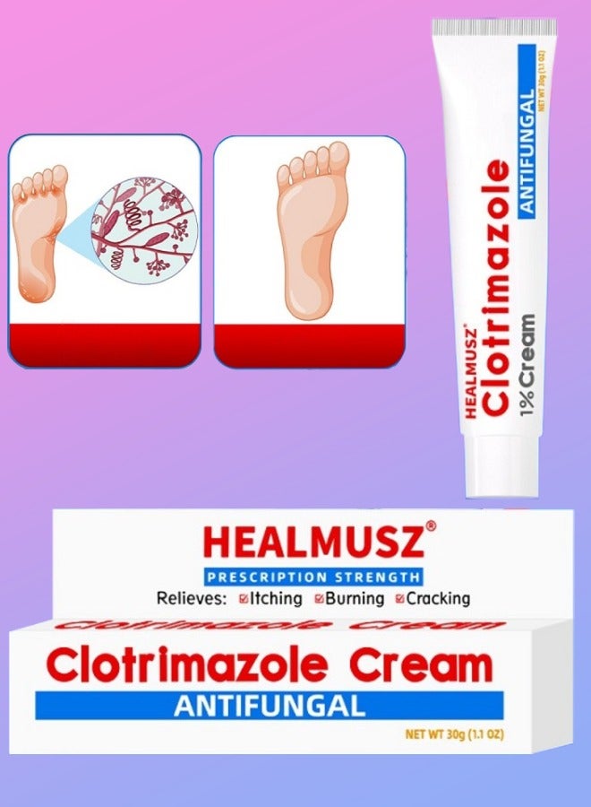 Clotrimazole Cream Athlete Foot Cream Jock Itch and Ringworm Cream Relieve Itching Burning Cracking & Scaling Clotrimazole Antifungal Cream Body Cream Athletes Foot Ointment  Anti Fungal Cream 30ml