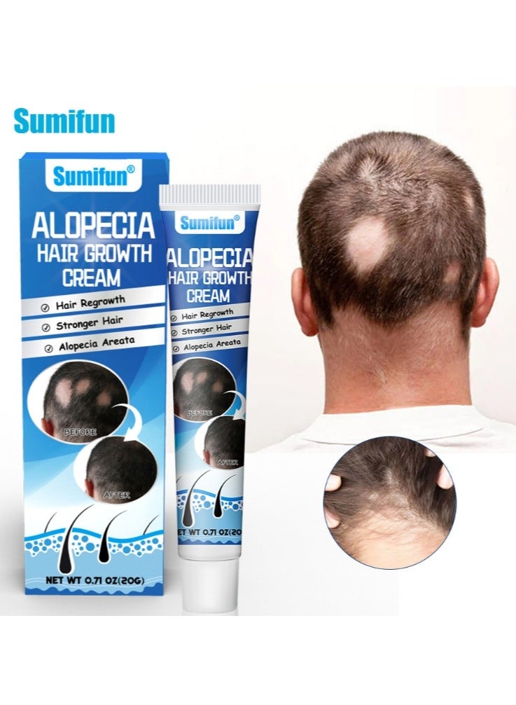 Alopecia Hair Growth Cream for Promote Men's Hair Growth,Prevent Hair Loss,Care for Hair, 20g