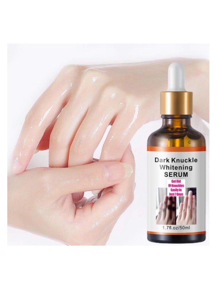 Dark Knuckle Whitening Serum 7 days Treatment for Dark Spots in Hand and Feet Knuckles Exfoliating Improves Dullness Powerful Whitening Effect for Men and Women 50ml