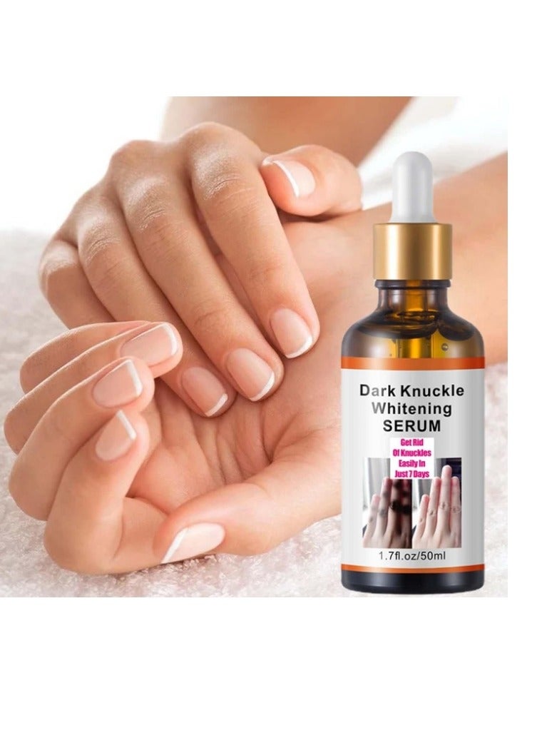 Dark Knuckle Whitening Serum 7 days Treatment for Dark Spots in Hand and Feet Knuckles Exfoliating Improves Dullness Powerful Whitening Effect for Men and Women 50ml