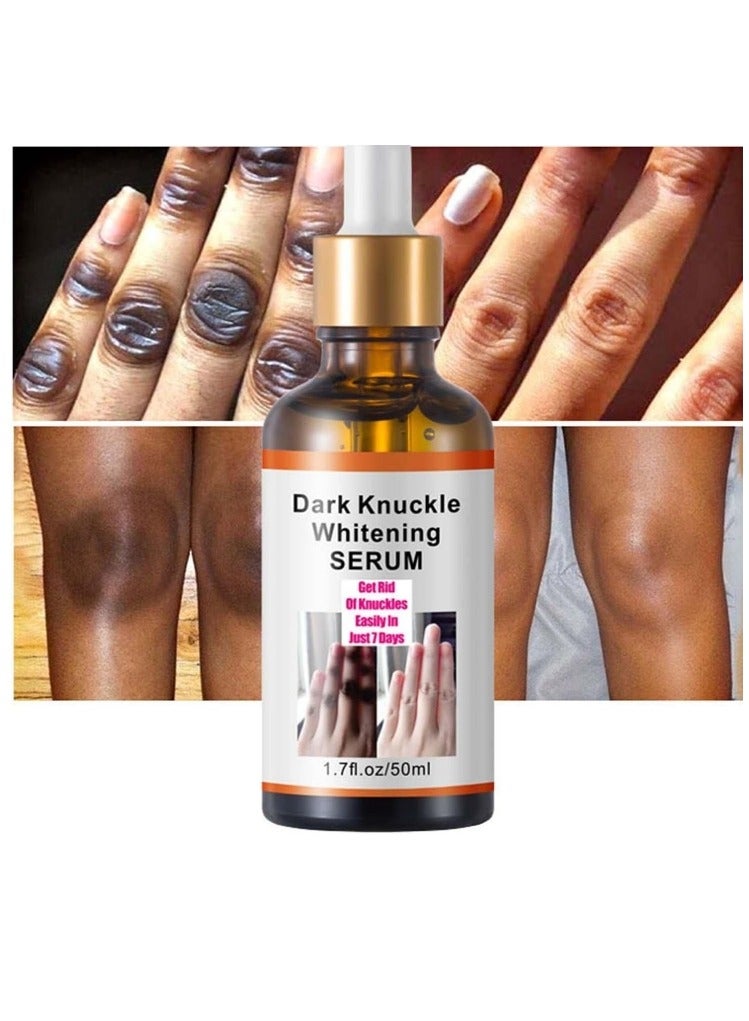 Dark Knuckle Whitening Serum 7 days Treatment for Dark Spots in Hand and Feet Knuckles Exfoliating Improves Dullness Powerful Whitening Effect for Men and Women 50ml