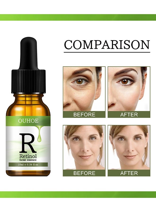 Retinol Facial Essence - Retinol 2.5% Professional Serum For Soft Glowing wrinkle Free Skin 10 ML