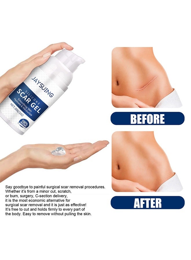 Silicone Scar Gel ,Scar Removal,Scar Treatment, Scar Removal Cream for C-Section, Stretch Marks, Acne, Surgery, Effective for Both Old and New Scars 30g