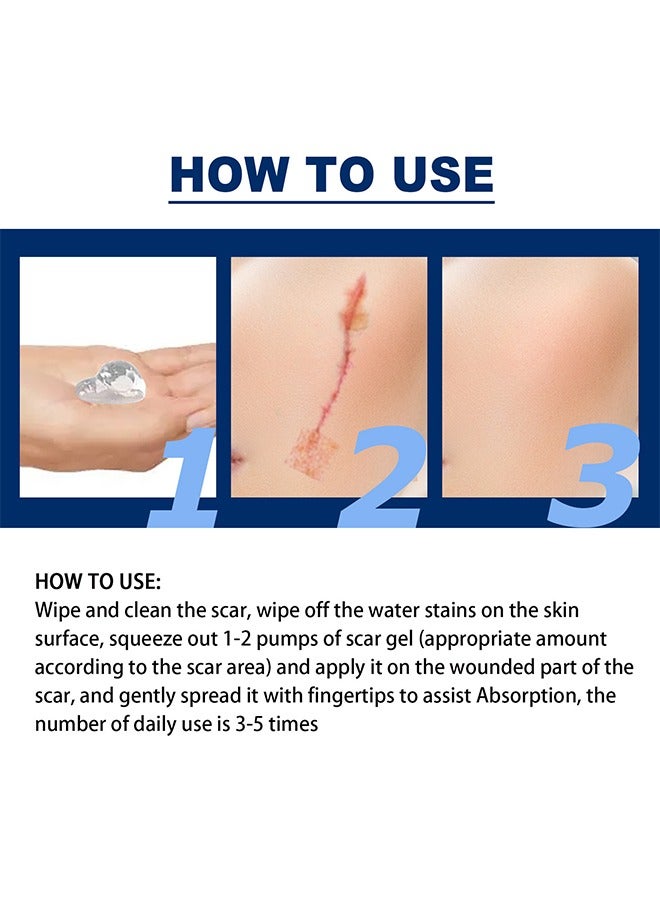 Silicone Scar Gel ,Scar Removal,Scar Treatment, Scar Removal Cream for C-Section, Stretch Marks, Acne, Surgery, Effective for Both Old and New Scars 30g