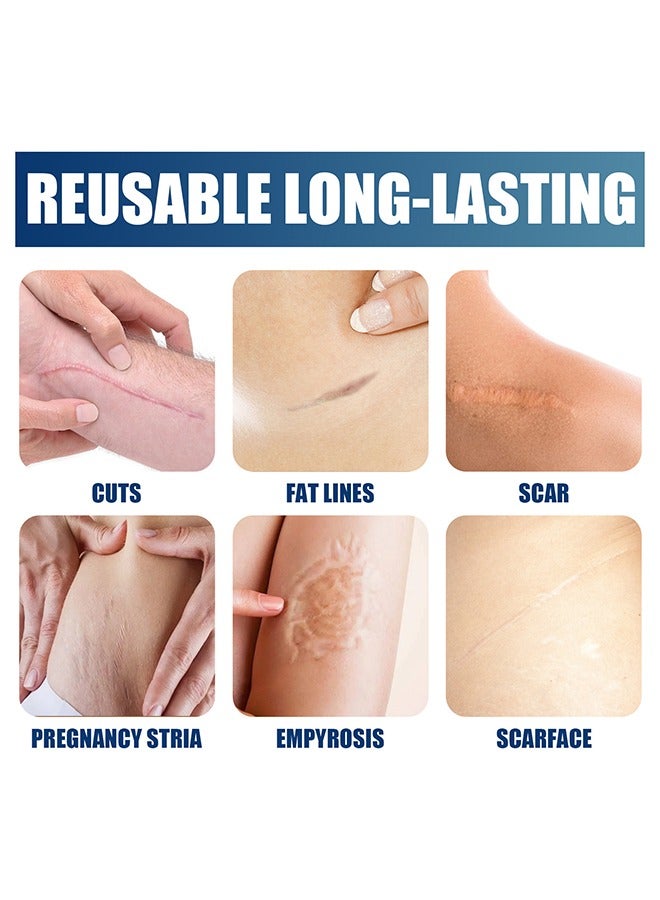 Silicone Scar Gel ,Scar Removal,Scar Treatment, Scar Removal Cream for C-Section, Stretch Marks, Acne, Surgery, Effective for Both Old and New Scars 30g