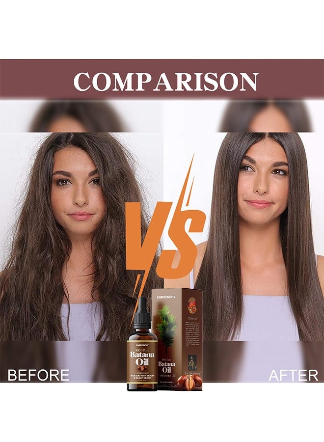 Batana Oil Rosemary Oil Hair Growth Serum - Nourish Scalp & Detox for Strong & Healthy Hair 100% Organic Batana Oil from Honduras with Rosemary - Reduce Hair Loss & Detox Your Scalp 30ml