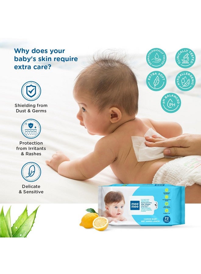 Soft Gentle Baby Wet Wipes (72 Wipes) Pack Of 3 | Infused With Aloe Vera And Lemon Extract | Paraben & Sulfate Free | Cleansing Wipes | Wipes Combo For Babies