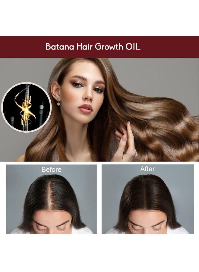 Batana Oil - For Hair Growth Dr Sebi Organic 100% Pure Concentrated Oil For Hair And Skin Care, Therapeutic Grade - 30Ml