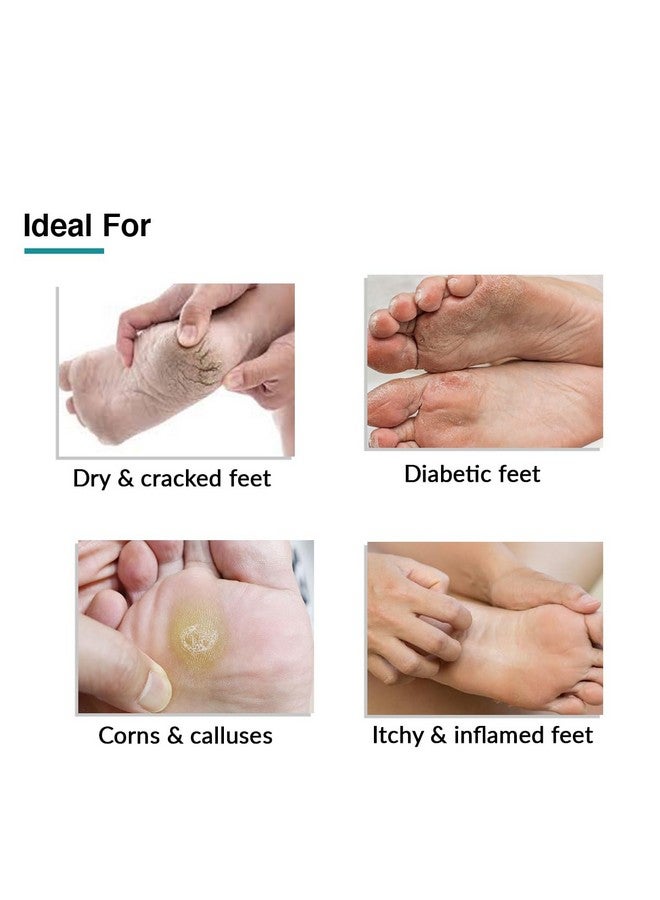 Foobetik Cream, Foot Cream, Foot Care, For Dry & Cracked Feet, Moisturizes & Soothes Feet, Heel Repair, For Calloused, Or Chapped Skin, Paraben Free 100Gm