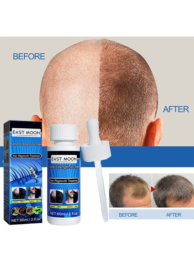 Extra Strength For Men -Minoxidil 5% Promote Men's Hair and Beard Growth,Prevent Hair Loss,Care for Hair 60ml