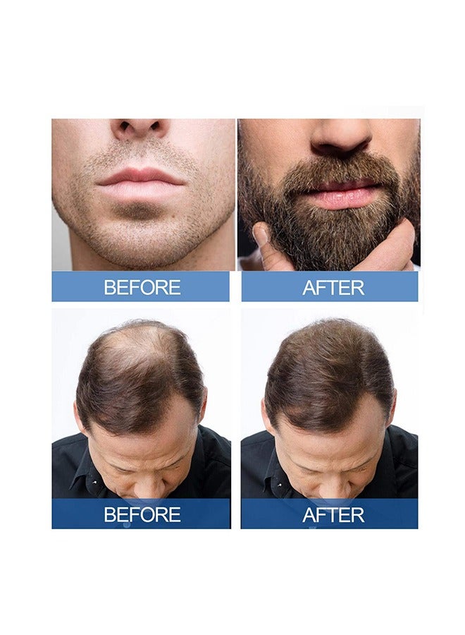 Extra Strength For Men -Minoxidil 5% Promote Men's Hair and Beard Growth,Prevent Hair Loss,Care for Hair 60ml