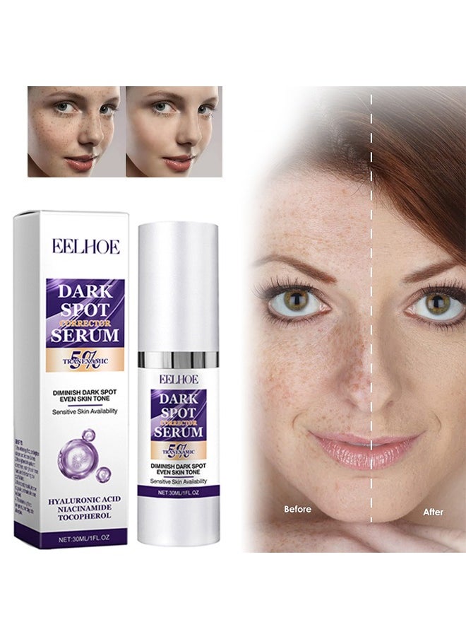 Dark Spot Corrector Serum -  Contains Salicylic Acid Niacinamide Facial Dark Spot Remover to Brightening Skin Tone Moisturizing Repair and Improve Facial Dull Moisturizing Essence, 30ml