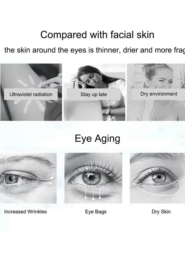 Nicotinamide Eye Cream Dark Circles Fading Anti Eye Bags, Hyaluronic Acid Moisturizing Serum for Puffiness and Eye Care