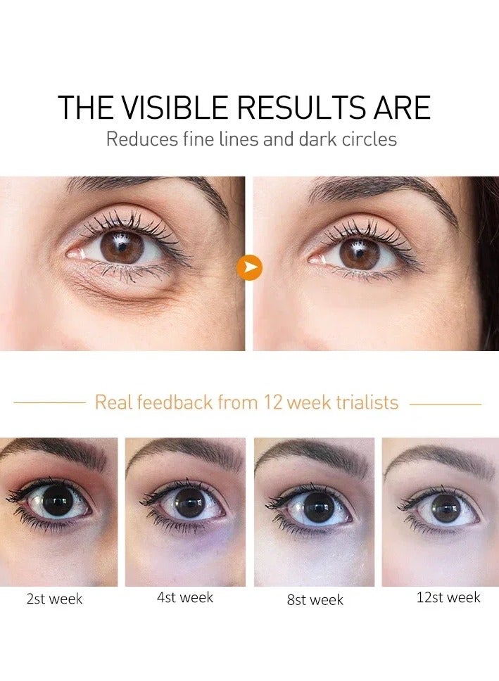 Peptide Eye Bags Eye Cream Anti Dark Circle Hyaluronic Acid Wrinkle Removal Cream with Roller Massager for Skin Care