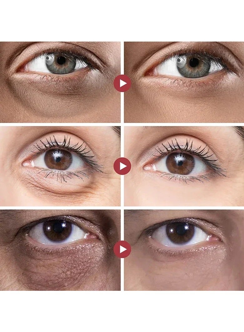 Peptide Eye Bags Eye Cream Anti Dark Circle Hyaluronic Acid Wrinkle Removal Cream with Roller Massager for Skin Care