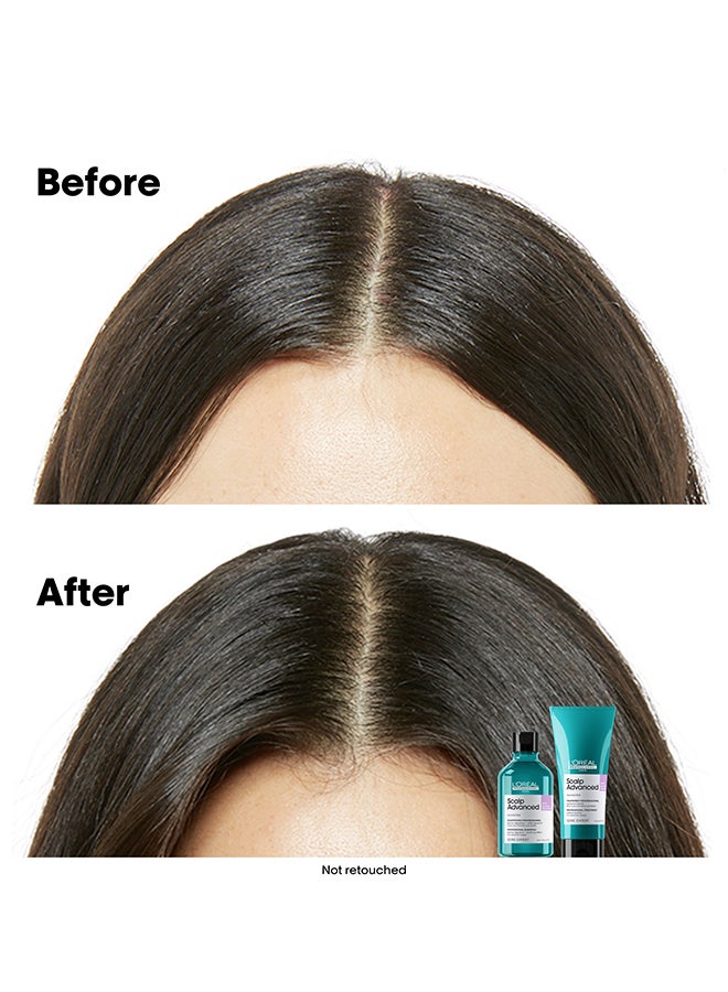 Scalp Advanced: Anti-Discomfort Glacial Utopia Duo Set | Shampoo 300Ml And Treatment 200Ml | Serie Expert