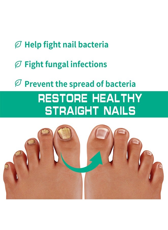 Nail Fungus Ointmen - Thickening, Brightening, and Repairing Solution for Damaged Nails on Hands and Feet