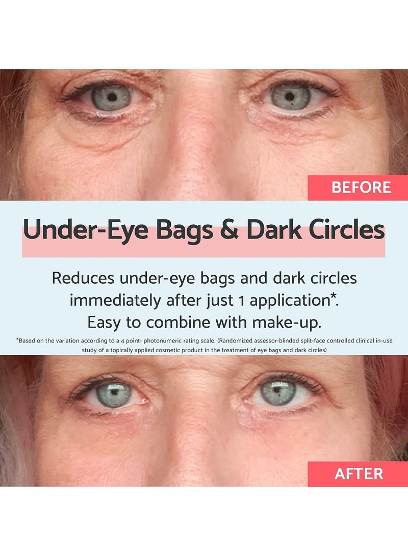 Eye Bags and Dark Circles 8ml Dark Circle Eye Cream for Under Eye Bags and Remove Bags Under Eyes Instant Eye Bag Remover 180 Applications