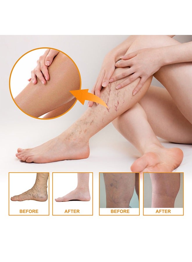 Vitamin K - Varicose Veins Cream, Soothing Leg Cream, Varicose and Spider Veins Treatment Cream, Improve Blood Circulation, Fast Relieve Swelling Pain 60g