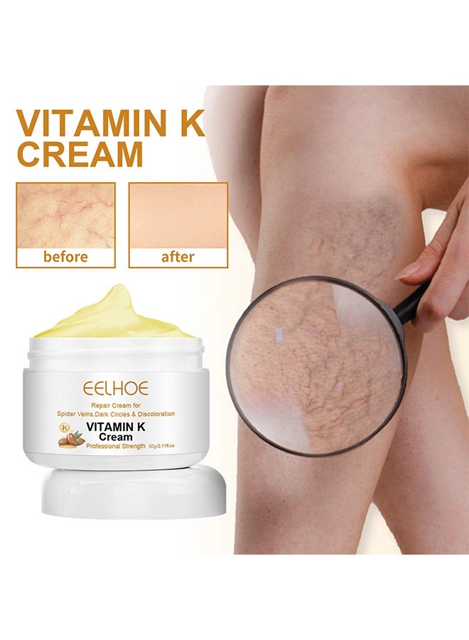 Vitamin K - Varicose Veins Cream, Soothing Leg Cream, Varicose and Spider Veins Treatment Cream, Improve Blood Circulation, Fast Relieve Swelling Pain 60g