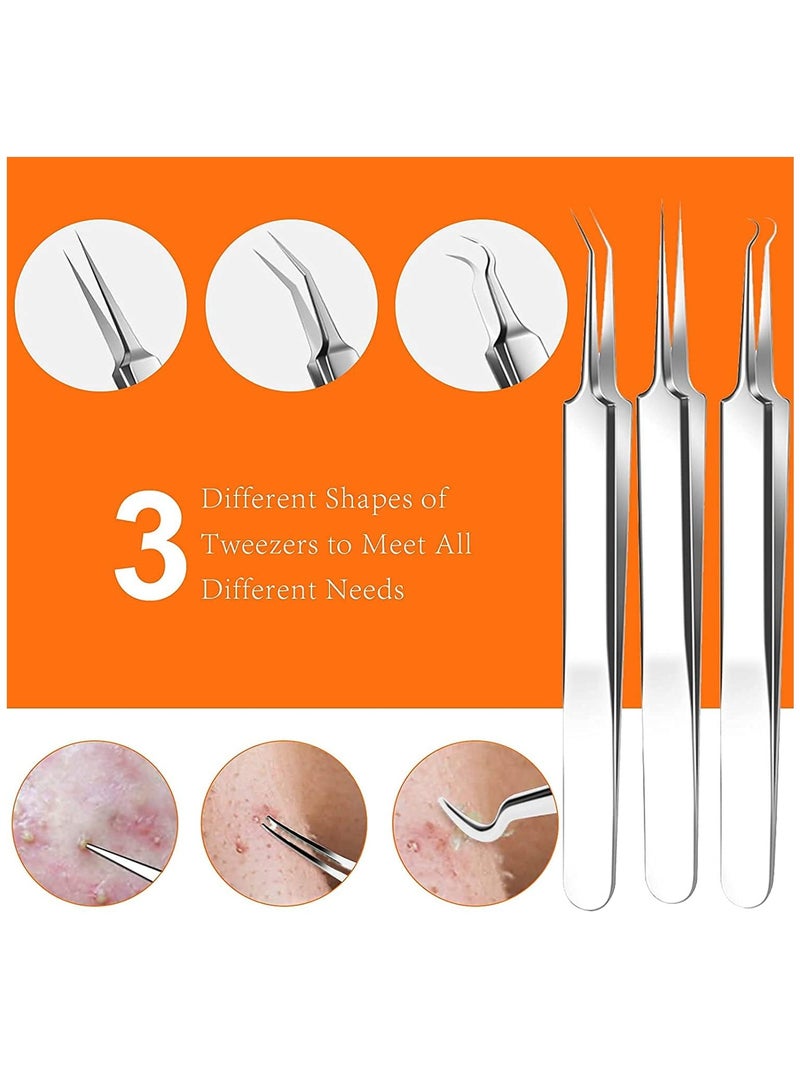 15 PCS Blackhead Remover Tools, Pimple Popper Tool Kit, Acne Extractor Tool, Professional Stainless Pimple Acne, Blemish Removal Tools Set with Metal Case