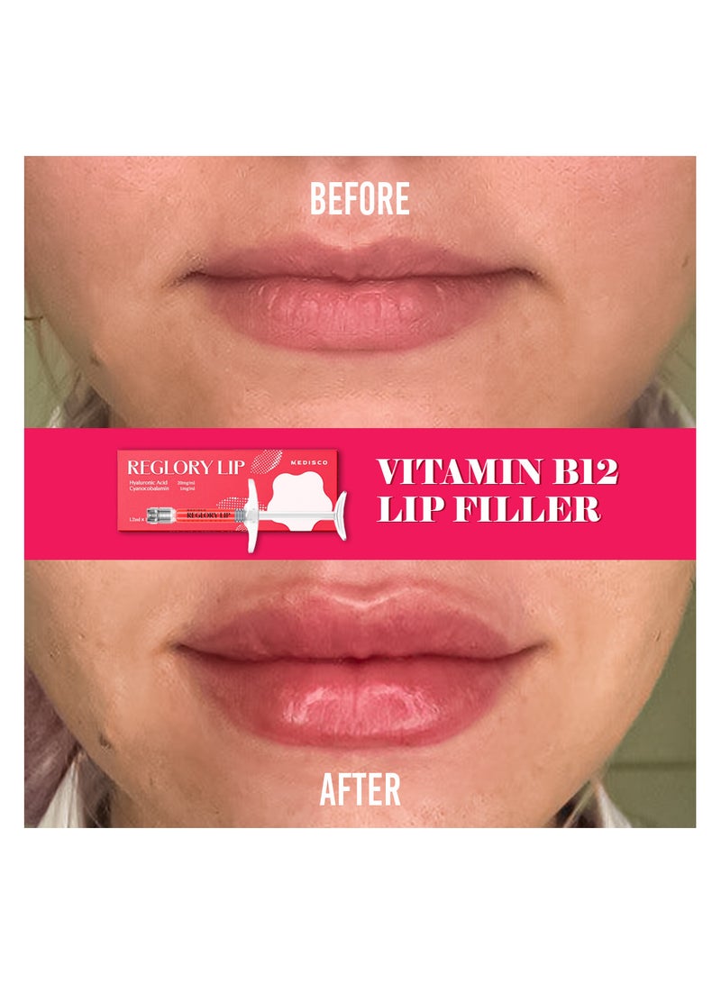 Medisco Reglory Vitamin B12 Lip Filler Natural Volume Hydration Color Boost with Healing Benefits