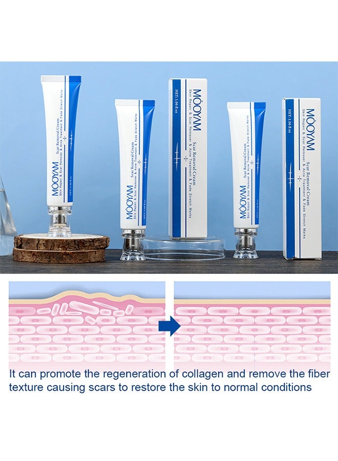 Scar Removal Cream, Skin Repairing Cream Fade Scars/Stretch Marks/Acne Treatment, Improve Scar Skin, Deeply Moisturizes Skin