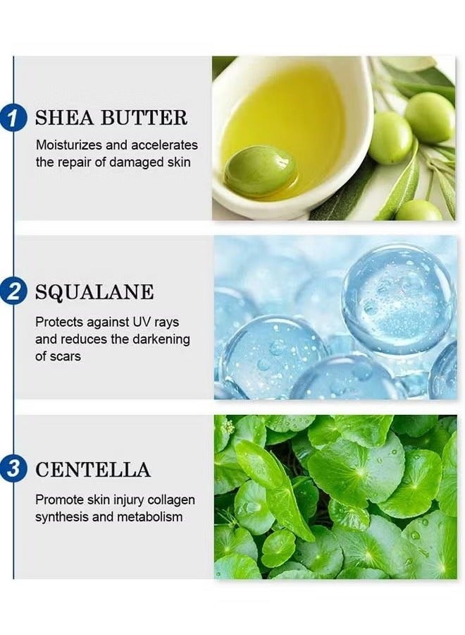 Scar Removal Cream, Skin Repairing Cream Fade Scars/Stretch Marks/Acne Treatment, Improve Scar Skin, Deeply Moisturizes Skin
