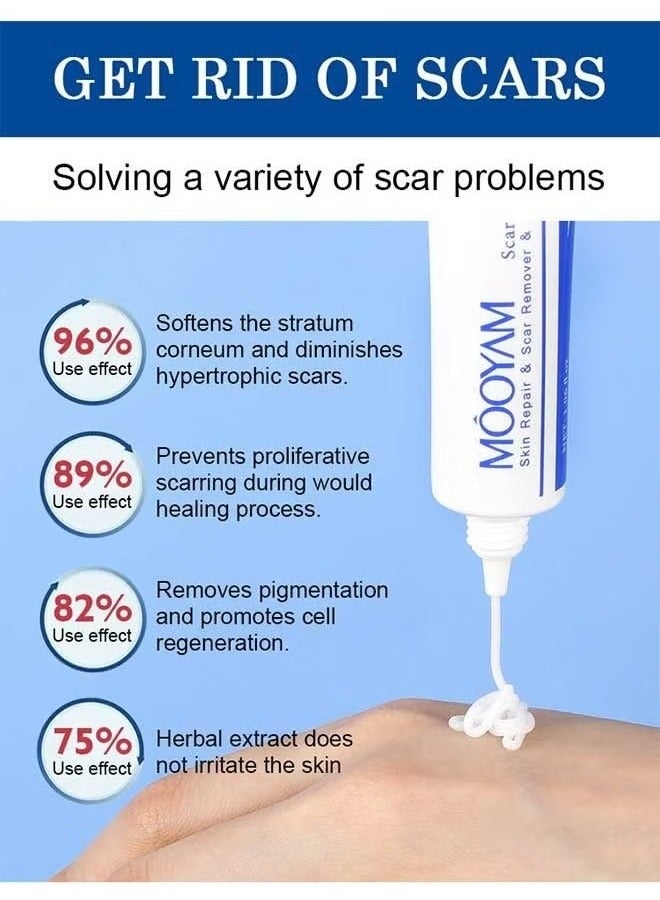 Scar Removal Cream, Skin Repairing Cream Fade Scars/Stretch Marks/Acne Treatment, Improve Scar Skin, Deeply Moisturizes Skin