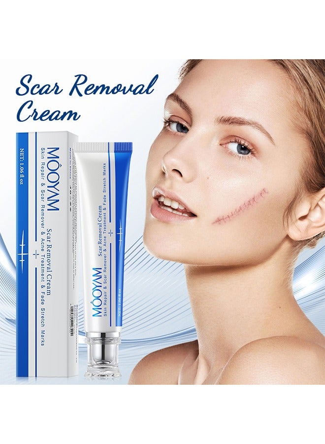 Scar Removal Cream, Skin Repairing Cream Fade Scars/Stretch Marks/Acne Treatment, Improve Scar Skin, Deeply Moisturizes Skin