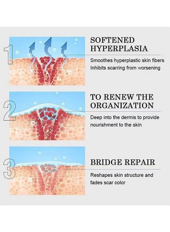 Scar Removal Cream, Skin Repairing Cream Fade Scars/Stretch Marks/Acne Treatment, Improve Scar Skin, Deeply Moisturizes Skin