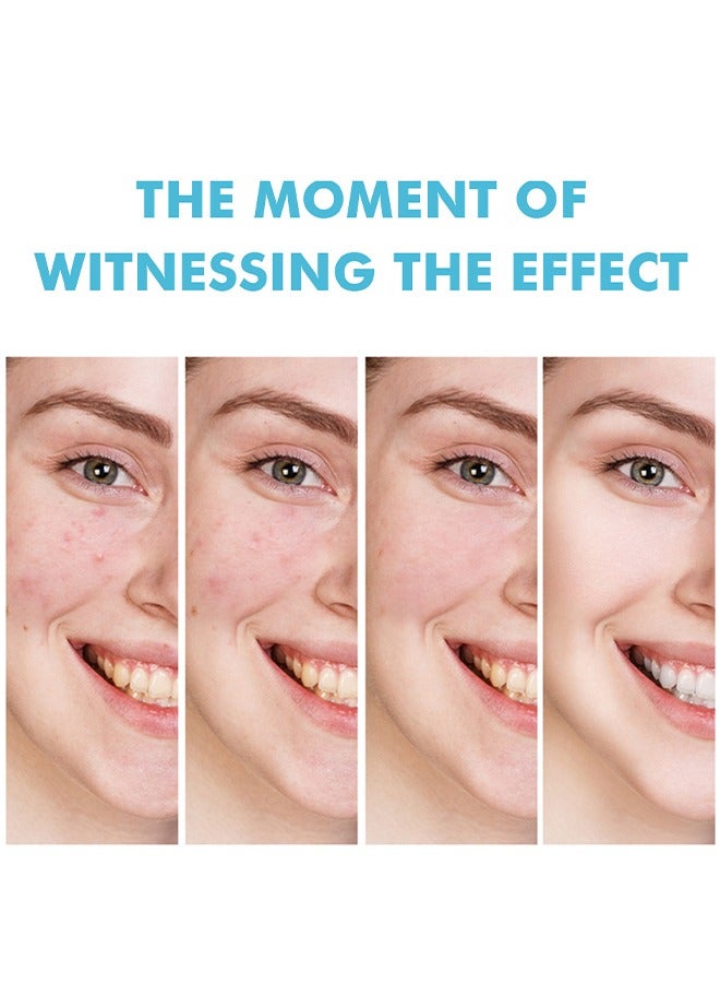 2 Pcs Salicylic Acid Remove Acne Gel, Rapid Action Acne Spot Treatment for Face Closure & Acne Dots, Premium Acne Scar Gel & Pimple Remover, 20g