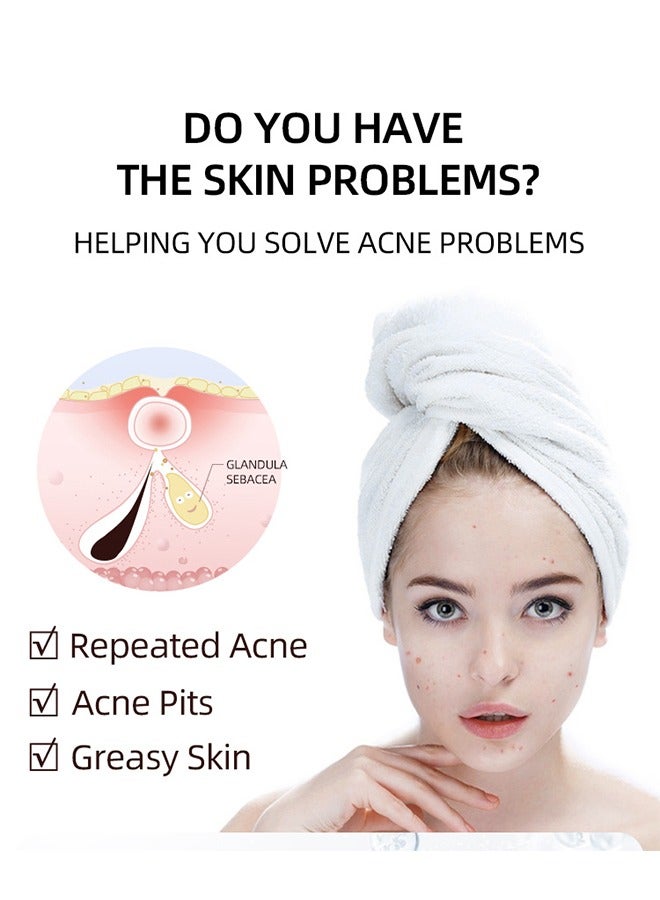 2 Pcs Salicylic Acid Remove Acne Gel, Rapid Action Acne Spot Treatment for Face Closure & Acne Dots, Premium Acne Scar Gel & Pimple Remover, 20g