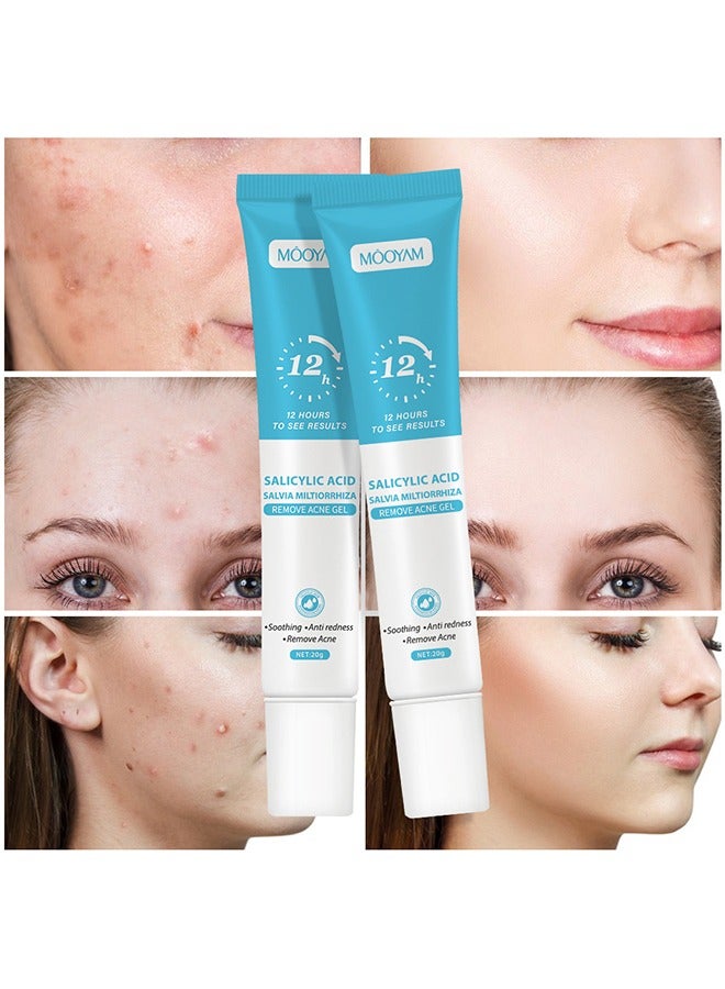 2 Pcs Salicylic Acid Remove Acne Gel, Rapid Action Acne Spot Treatment for Face Closure & Acne Dots, Premium Acne Scar Gel & Pimple Remover, 20g