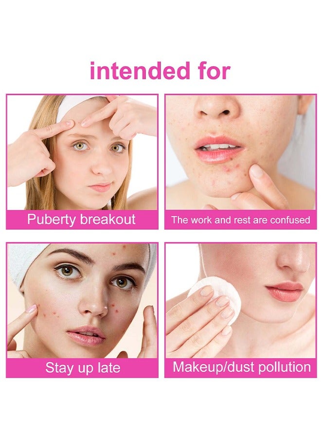 Pimple Acne Patches, Butterfly-shaped Acne Absorbing Cover Patch Hydrocolloid Spot Dots Stickers for Acne, Blemish, Pimples, Whiteheads Zit (160 Patches)