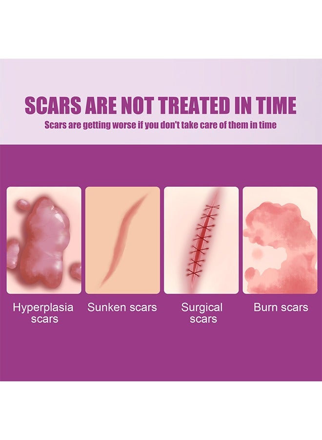 Scar Cream Fade Scald Scar Surgical Repair Cream, Lighten Scars Surgical Scars, Smooth Skin Repair,50 g