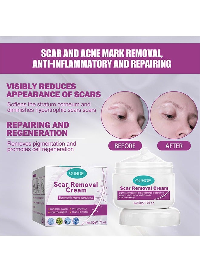 Scar Cream Fade Scald Scar Surgical Repair Cream, Lighten Scars Surgical Scars, Smooth Skin Repair,50 g