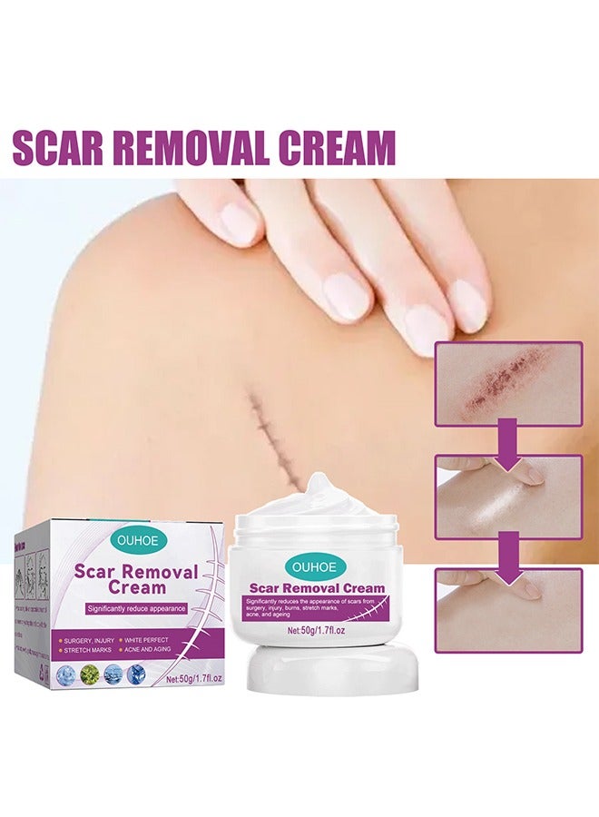 Scar Cream Fade Scald Scar Surgical Repair Cream, Lighten Scars Surgical Scars, Smooth Skin Repair,50 g