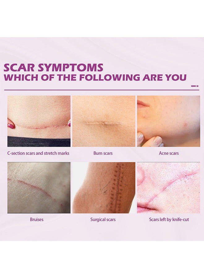 Scar Cream Fade Scald Scar Surgical Repair Cream, Lighten Scars Surgical Scars, Smooth Skin Repair,50 g