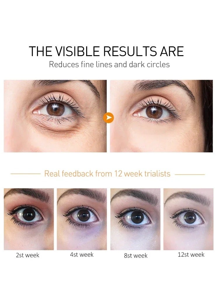 Peptide Eye Bags Eye Cream with Hyaluronic Acid for Anti Dark Circle Wrinkle Removal with Roller Massager for Skincare Beauty