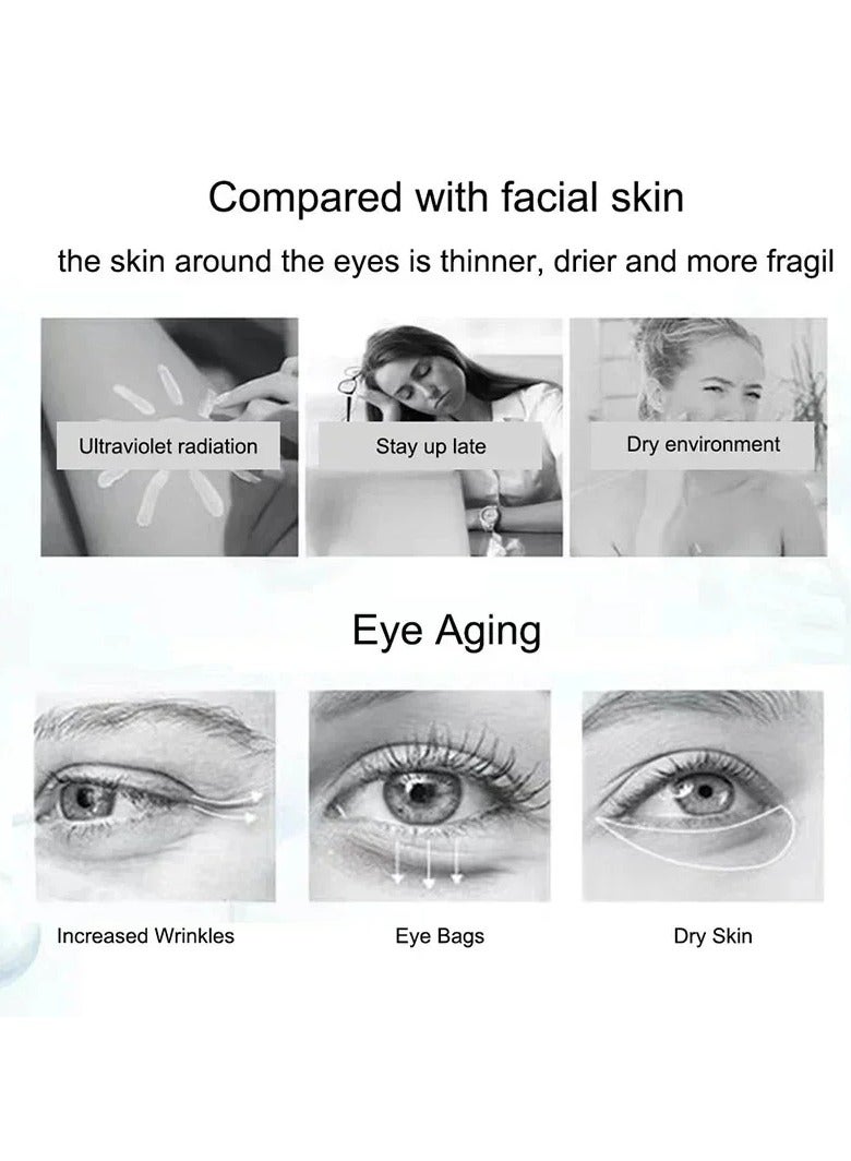 Nicotinamide Eyes Cream with Hyaluronic Acid for Dark Circles Fading Eye Bags Against Puffiness Moisturizing Eye Care Gel