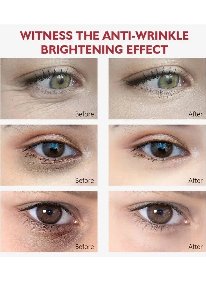 Nicotinamide Eyes Cream with Hyaluronic Acid for Dark Circles Fading Eye Bags Against Puffiness Moisturizing Eye Care Gel